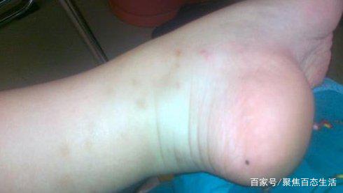 痣长在什么地方有什么说法痣长位置与命运之说，探寻身体痣相学的奥秘